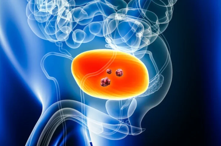 Urological Cancer-------0